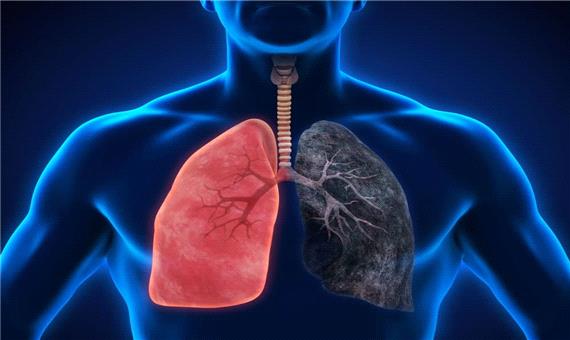 پاکسازی ریه‌ها راهی برای پیشگیری از بیماری‌های مرگبار تنفسی