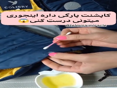 اگه کاپشنت پارگی داره اینجوری درستش کن!