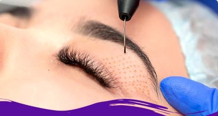 بهترین روش بلفاروپلاستی پلک بالا بدون جای بخیه