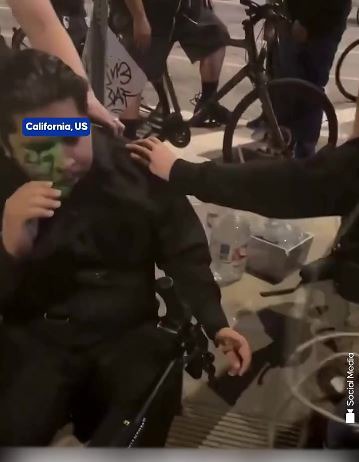 شلیک گلوله حاوی فلفل به چشم یک معترض در لس‌آنجلس