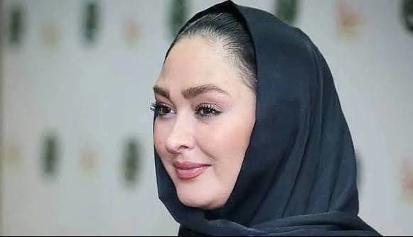 چهره ها/ کنایه سنگین کاربران به تغییر چهره الهام حمیدی